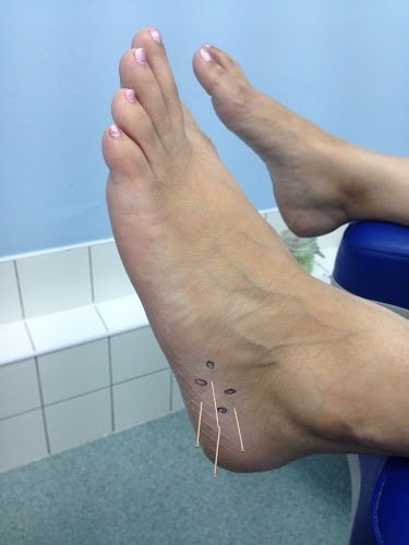 Foot Clinic Harborne