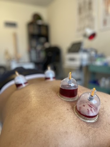 profile picture of Cupping & Acupuncture Manchester £45* | The Holistic Health Centre profile picture