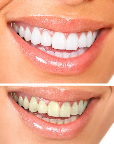 Smart Dental Care - Smile Spa