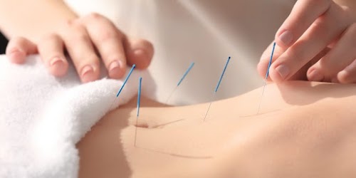 profile picture of Balance Acupuncture