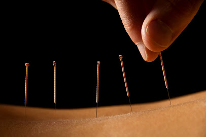 profile picture of Sunny Jaspal Acupuncture profile picture