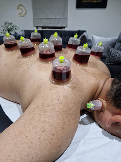 Ipswich Hijama cupping therapy