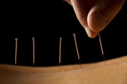 profile picture of MH Acupuncture Therapies profile picture