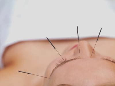 profile picture of Acupuncture Cumbria profile picture