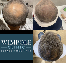 profile picture of Wimpole Hair Transplant Clinic Newcastle