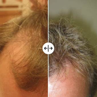 profile picture of Wimpole Hair Transplant Clinic Newcastle